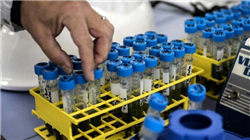 日本国债收益率上涨 因可能出台的刺激计划引发财政担忧