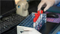 工大高科前三季度净利润大降逾七成 此前多位高管减持